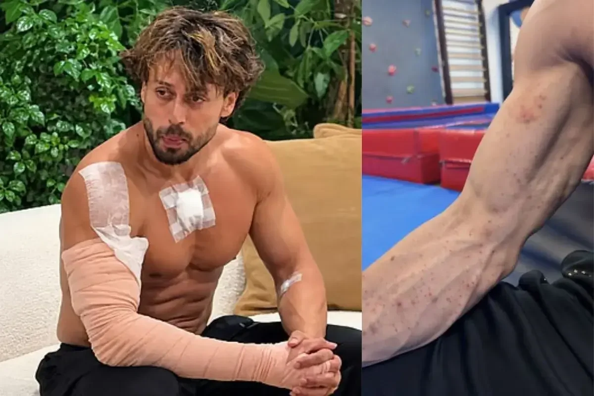 Tiger Shroff's Team Reveals Gunpowder Burn Marks, Warns Trolls of Legal Action
